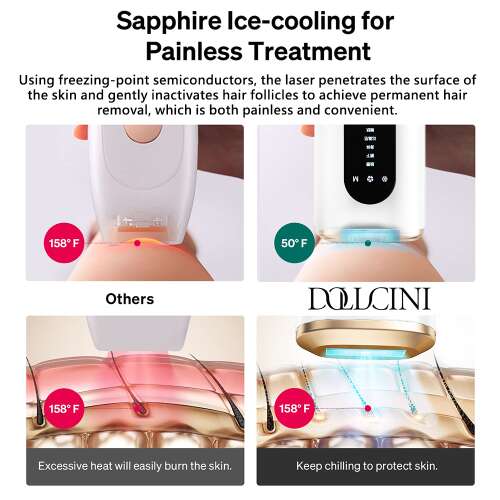 Epilare IPL Dollcini - Dispozitiv laser cu puls infinit rece, cu moduri reglabile, pentru întregul corp, pentru femei și bărbați